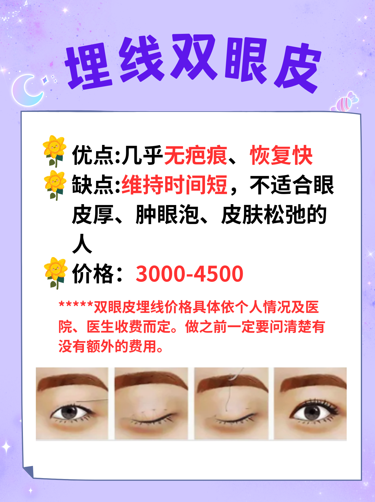 埋线双眼皮价格详解，了解大致费用